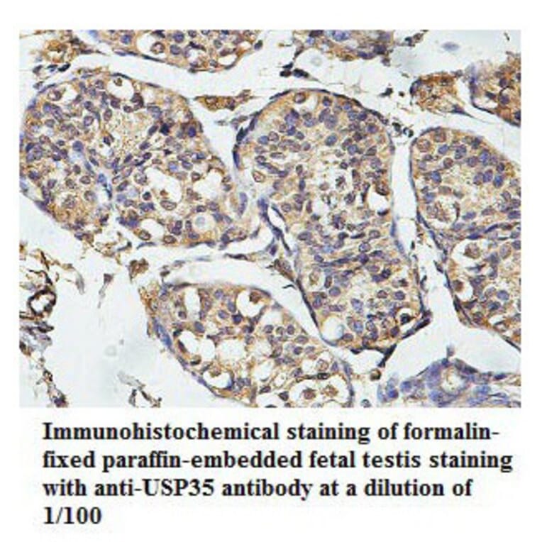 USP35 Antibody from Signalway Antibody (39789) - Antibodies.com