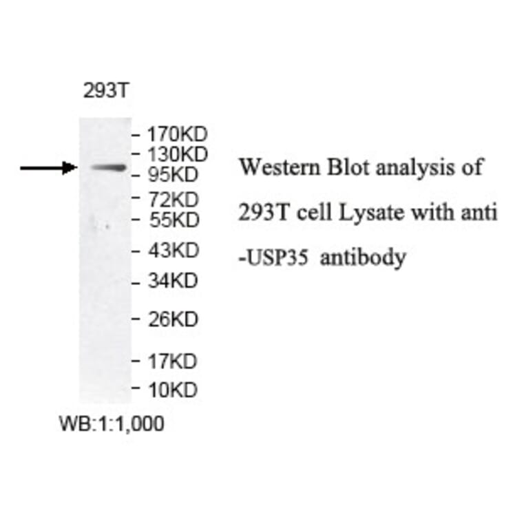 USP35 Antibody from Signalway Antibody (39789) - Antibodies.com