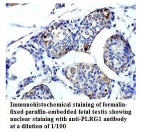 PLRG1 Antibody from Signalway Antibody (39794) - Antibodies.com