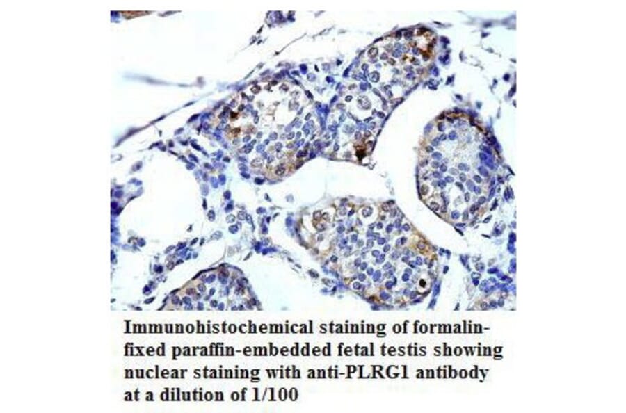 PLRG1 Antibody from Signalway Antibody (39794) - Antibodies.com