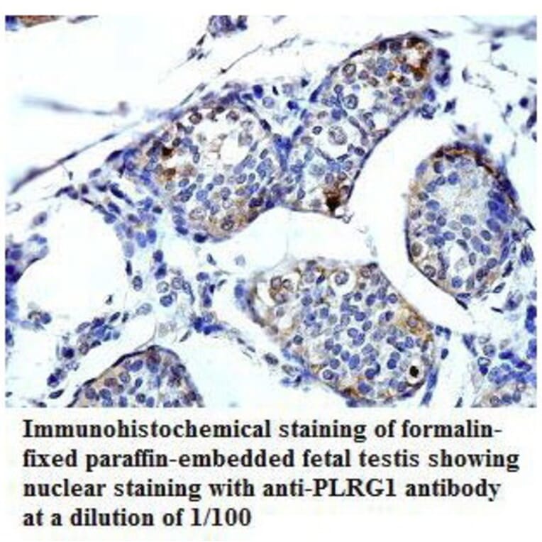 PLRG1 Antibody from Signalway Antibody (39794) - Antibodies.com