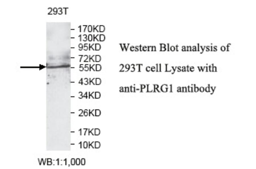 PLRG1 Antibody from Signalway Antibody (39794) - Antibodies.com