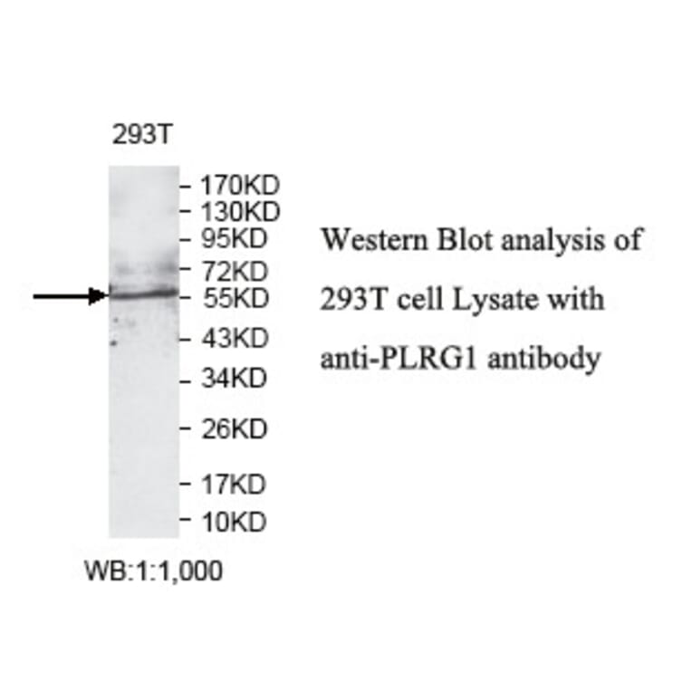 PLRG1 Antibody from Signalway Antibody (39794) - Antibodies.com