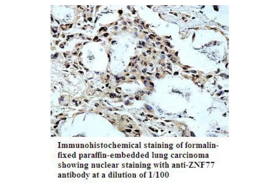 ZNF77 Antibody from Signalway Antibody (39797) - Antibodies.com