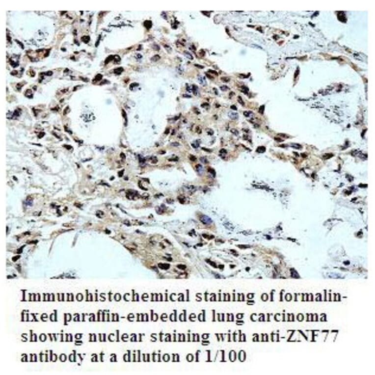 ZNF77 Antibody from Signalway Antibody (39797) - Antibodies.com