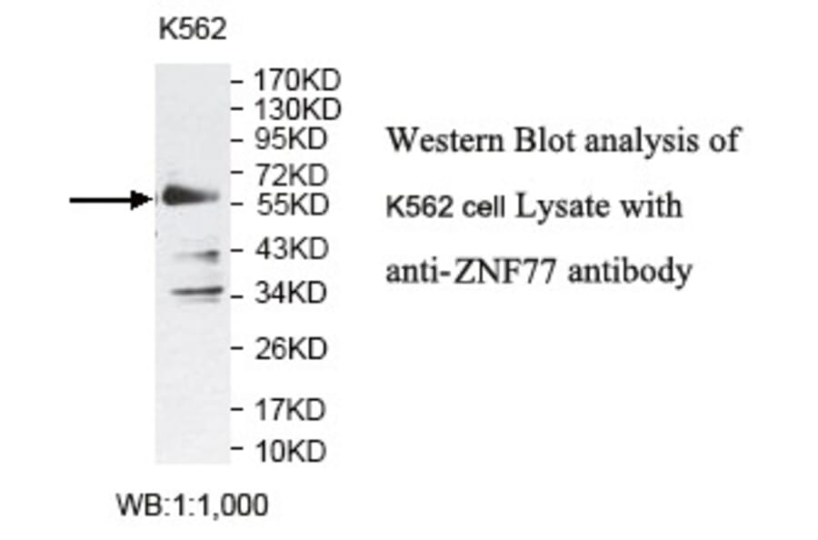 ZNF77 Antibody from Signalway Antibody (39797) - Antibodies.com