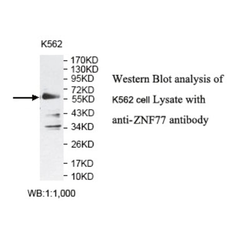 ZNF77 Antibody from Signalway Antibody (39797) - Antibodies.com