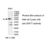 ZNF77 Antibody from Signalway Antibody (39797) - Antibodies.com
