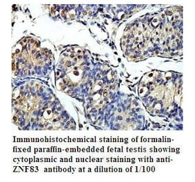 ZNF83 Antibody from Signalway Antibody (39799) - Antibodies.com