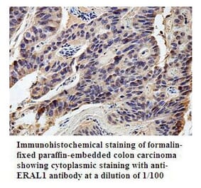 ERAL1 Antibody from Signalway Antibody (39800) - Antibodies.com