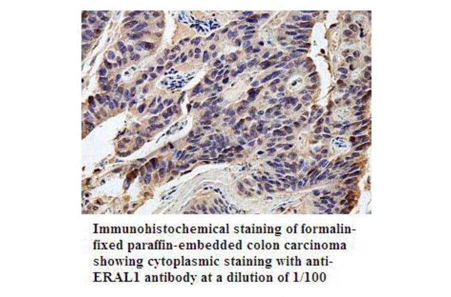 ERAL1 Antibody from Signalway Antibody (39800) - Antibodies.com
