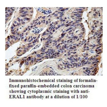 ERAL1 Antibody from Signalway Antibody (39800) - Antibodies.com