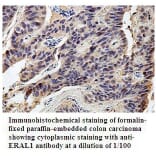 ERAL1 Antibody from Signalway Antibody (39800) - Antibodies.com