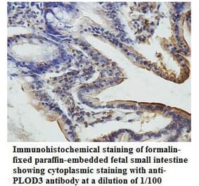 PLOD3 Antibody from Signalway Antibody (39809) - Antibodies.com