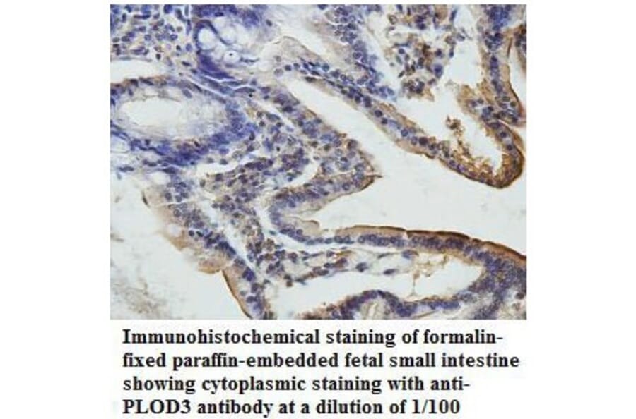 PLOD3 Antibody from Signalway Antibody (39809) - Antibodies.com