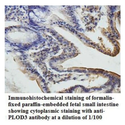 PLOD3 Antibody from Signalway Antibody (39809) - Antibodies.com