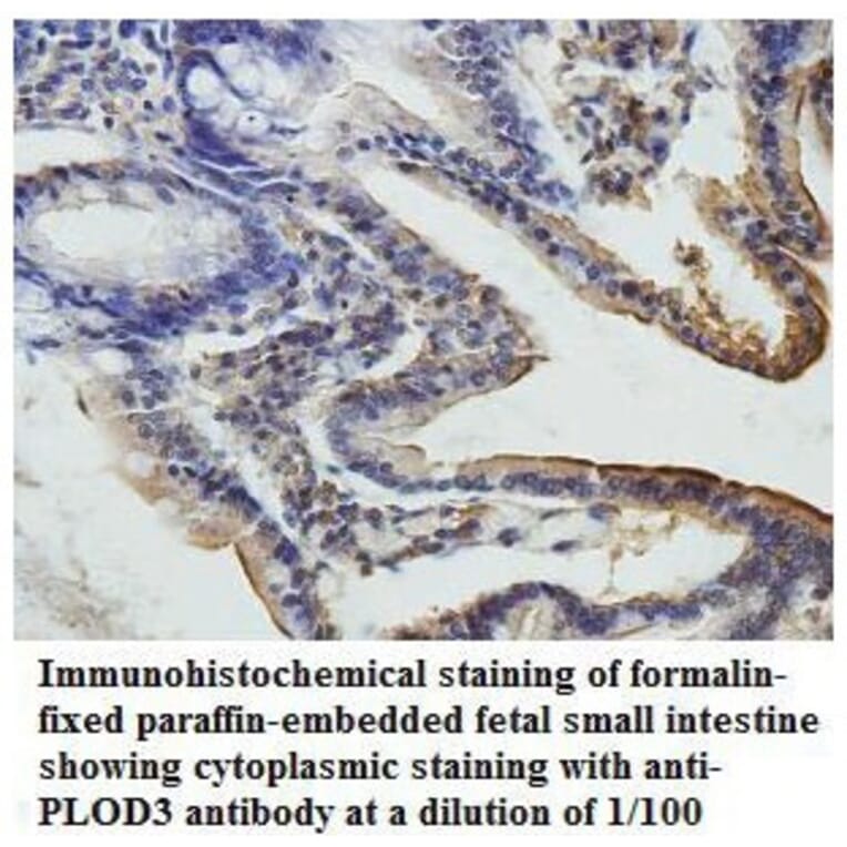 PLOD3 Antibody from Signalway Antibody (39809) - Antibodies.com