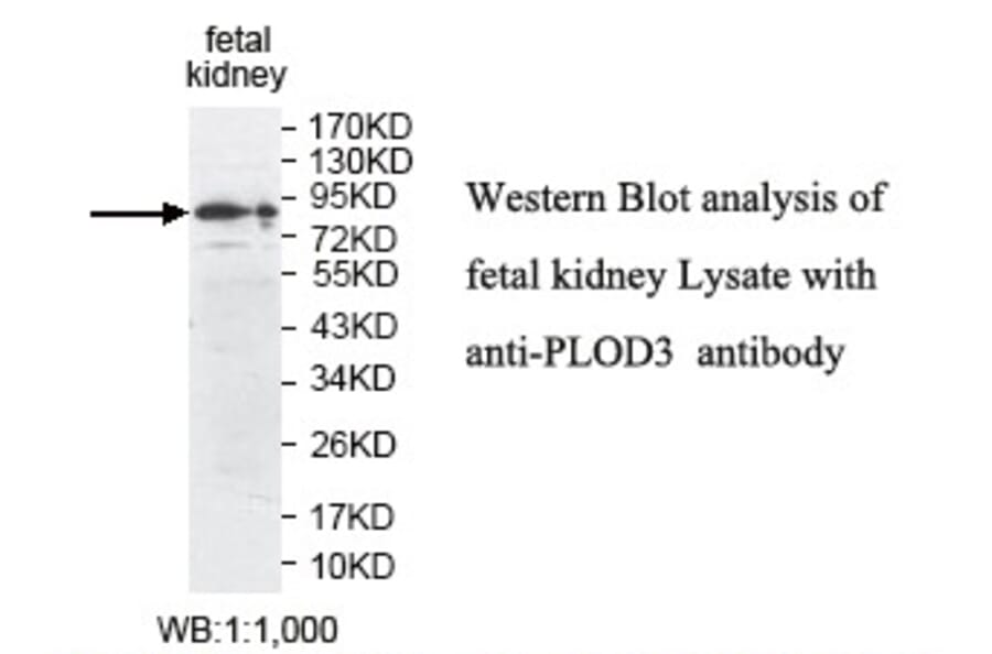 PLOD3 Antibody from Signalway Antibody (39809) - Antibodies.com