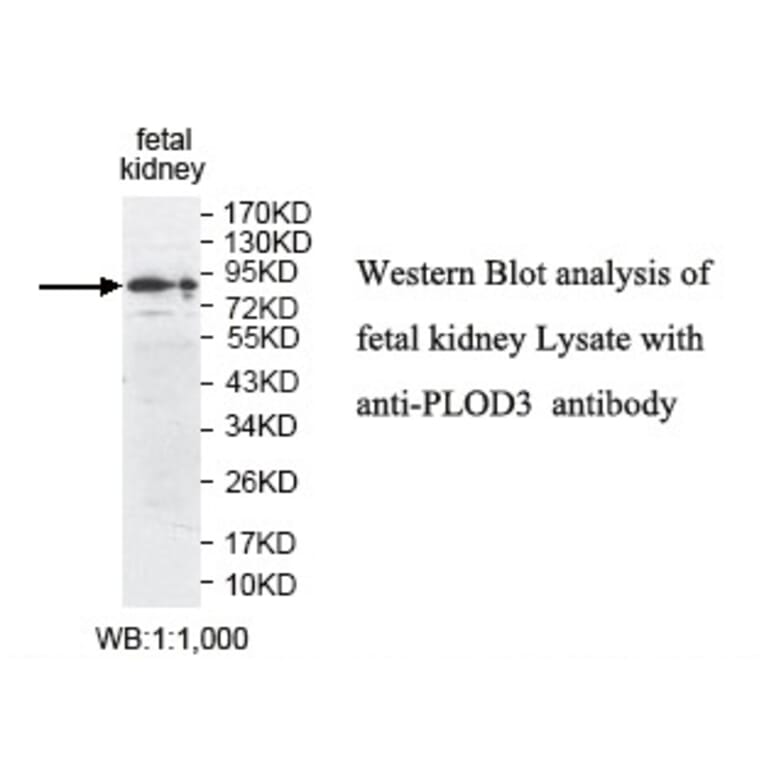 PLOD3 Antibody from Signalway Antibody (39809) - Antibodies.com