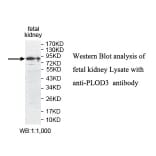 PLOD3 Antibody from Signalway Antibody (39809) - Antibodies.com