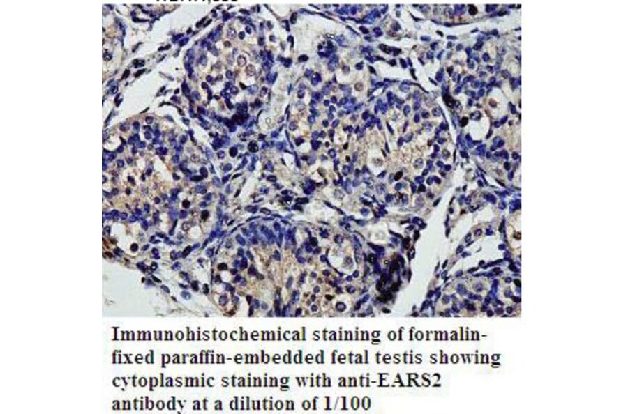 EARS2 Antibody from Signalway Antibody (39812) - Antibodies.com