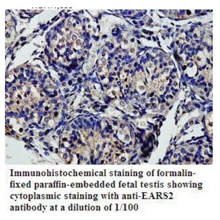 EARS2 Antibody from Signalway Antibody (39812) - Antibodies.com