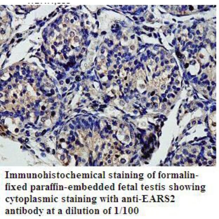 EARS2 Antibody from Signalway Antibody (39812) - Antibodies.com