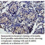 EARS2 Antibody from Signalway Antibody (39812) - Antibodies.com