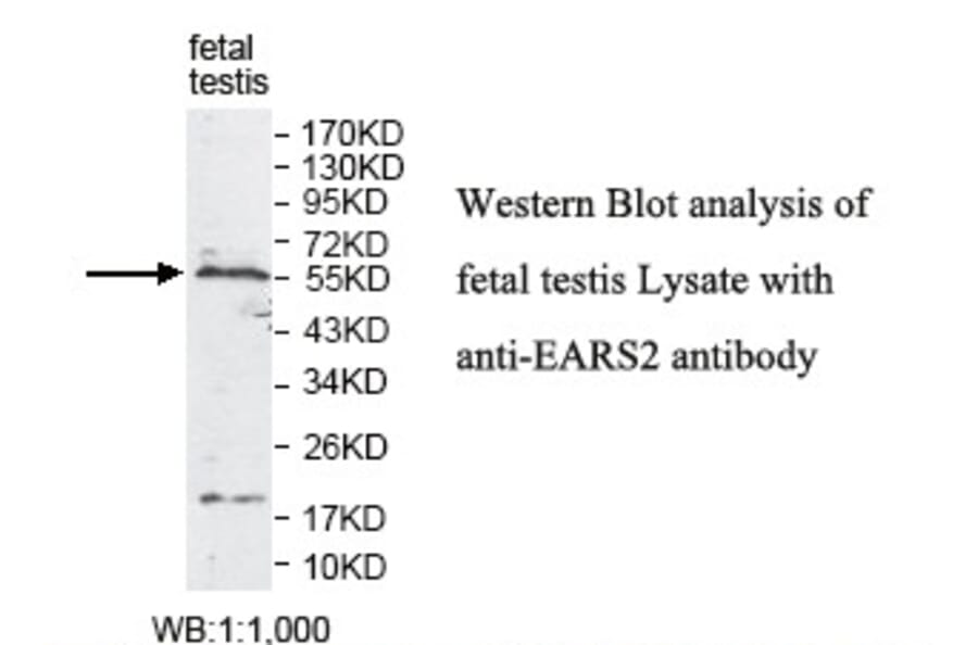 EARS2 Antibody from Signalway Antibody (39812) - Antibodies.com