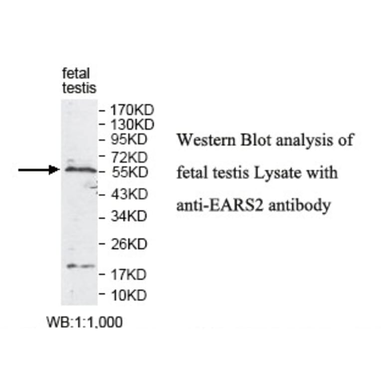 EARS2 Antibody from Signalway Antibody (39812) - Antibodies.com