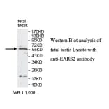 EARS2 Antibody from Signalway Antibody (39812) - Antibodies.com