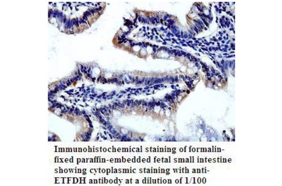 ETFDH Antibody from Signalway Antibody (39813) - Antibodies.com