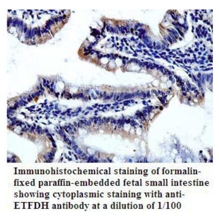 ETFDH Antibody from Signalway Antibody (39813) - Antibodies.com