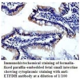 ETFDH Antibody from Signalway Antibody (39813) - Antibodies.com