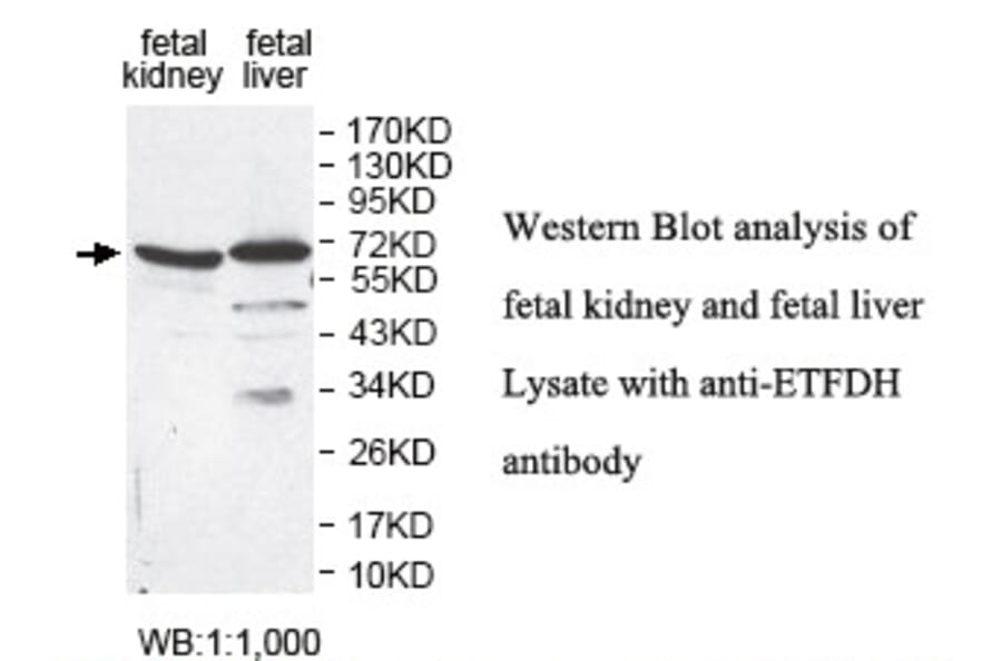 ETFDH Antibody from Signalway Antibody (39813) - Antibodies.com