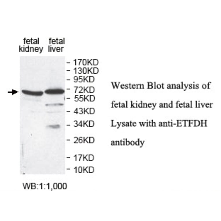 ETFDH Antibody from Signalway Antibody (39813) - Antibodies.com