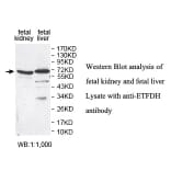 ETFDH Antibody from Signalway Antibody (39813) - Antibodies.com