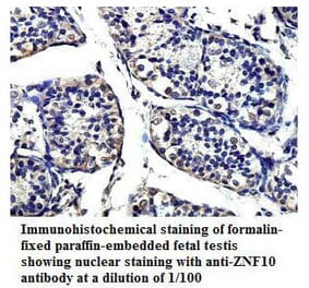 ZNF10 Antibody from Signalway Antibody (39814) - Antibodies.com
