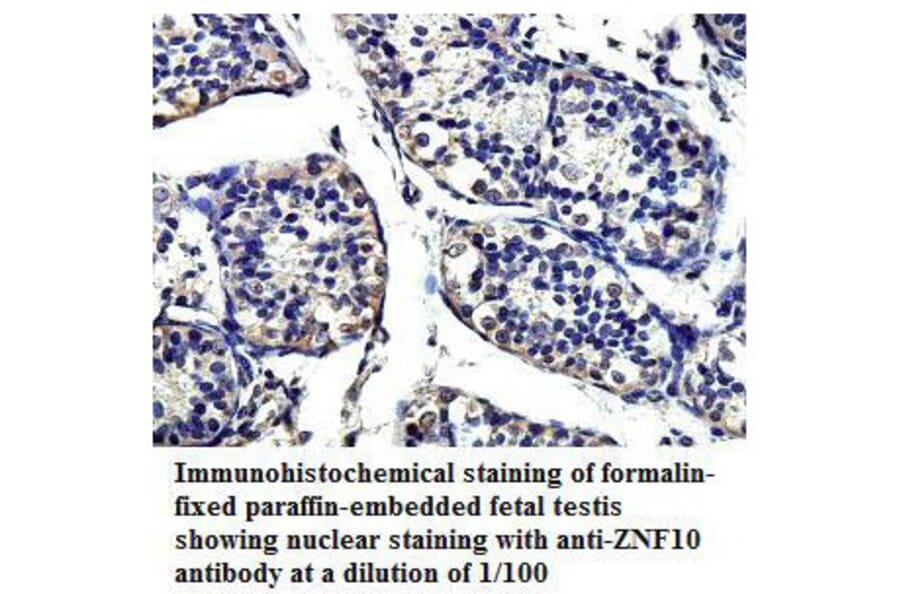 ZNF10 Antibody from Signalway Antibody (39814) - Antibodies.com