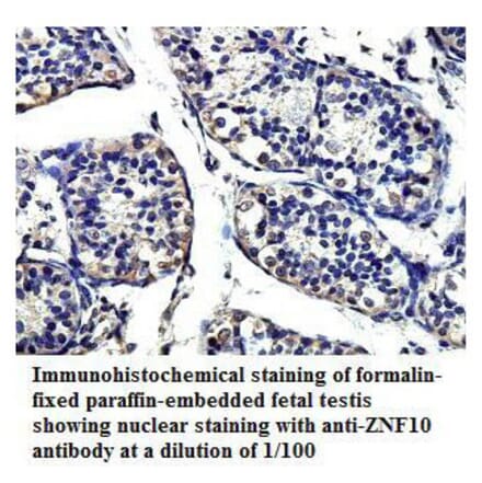 ZNF10 Antibody from Signalway Antibody (39814) - Antibodies.com
