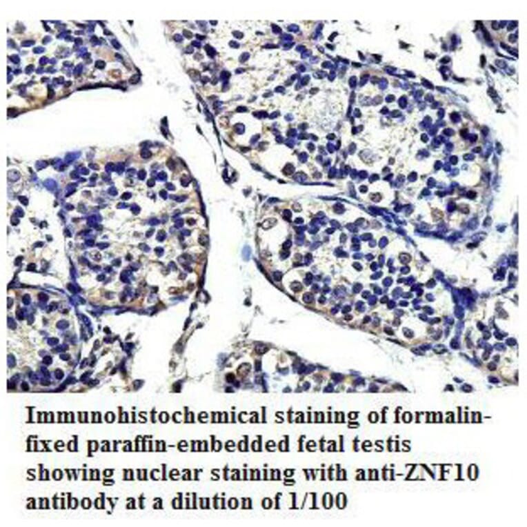 ZNF10 Antibody from Signalway Antibody (39814) - Antibodies.com