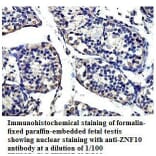 ZNF10 Antibody from Signalway Antibody (39814) - Antibodies.com