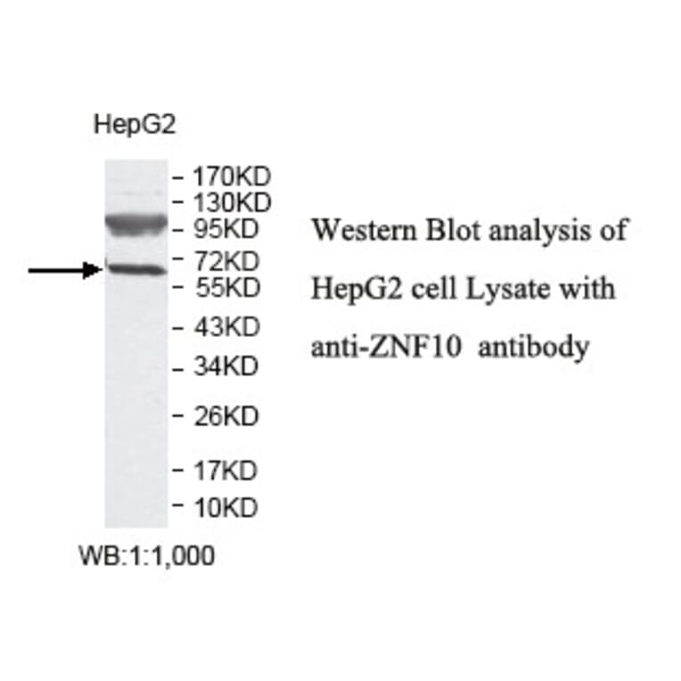 ZNF10 Antibody from Signalway Antibody (39814) - Antibodies.com