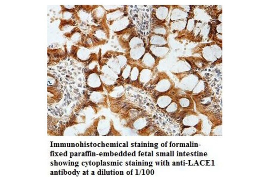 LACE1 Antibody from Signalway Antibody (39826) - Antibodies.com