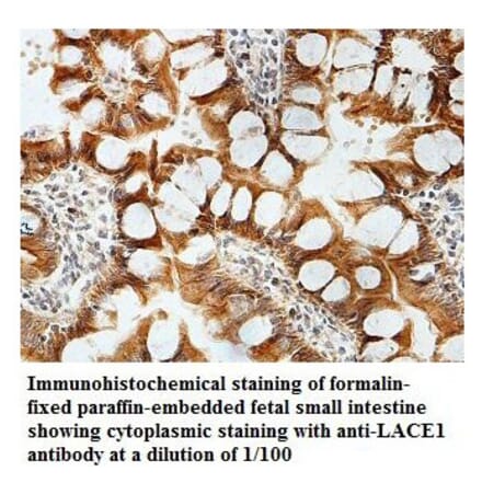 LACE1 Antibody from Signalway Antibody (39826) - Antibodies.com