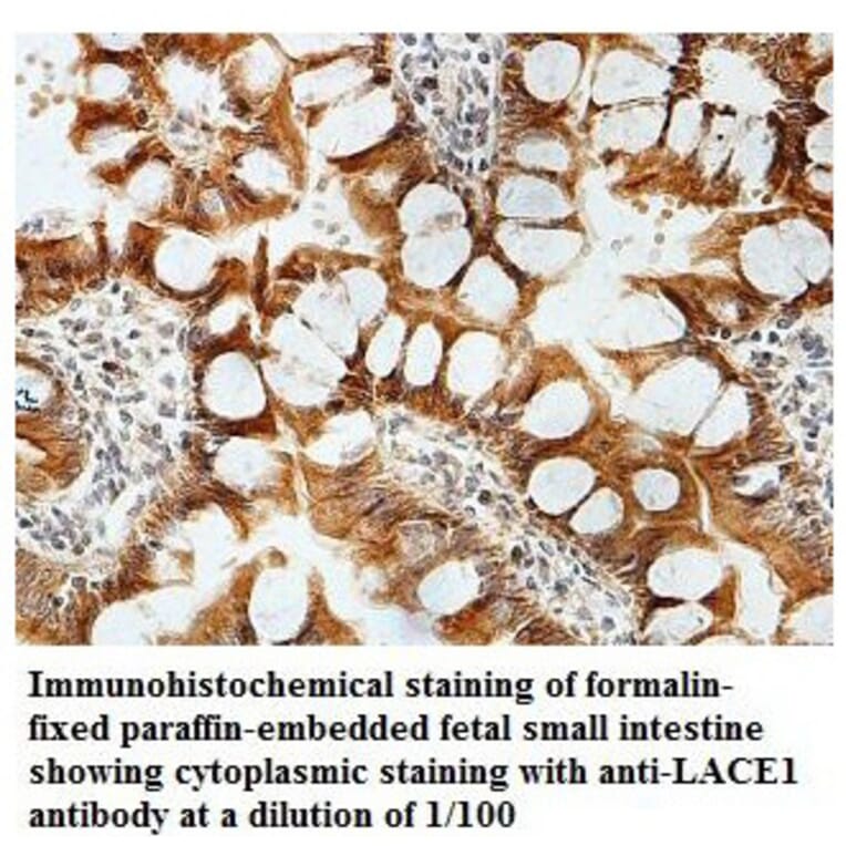 LACE1 Antibody from Signalway Antibody (39826) - Antibodies.com
