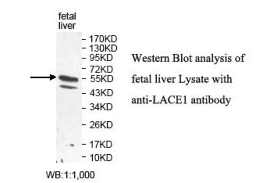 LACE1 Antibody from Signalway Antibody (39826) - Antibodies.com