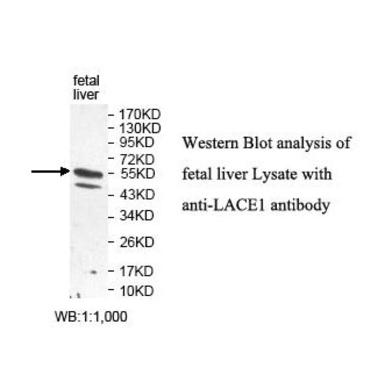 LACE1 Antibody from Signalway Antibody (39826) - Antibodies.com