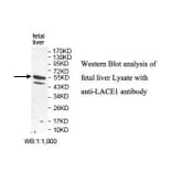 LACE1 Antibody from Signalway Antibody (39826) - Antibodies.com