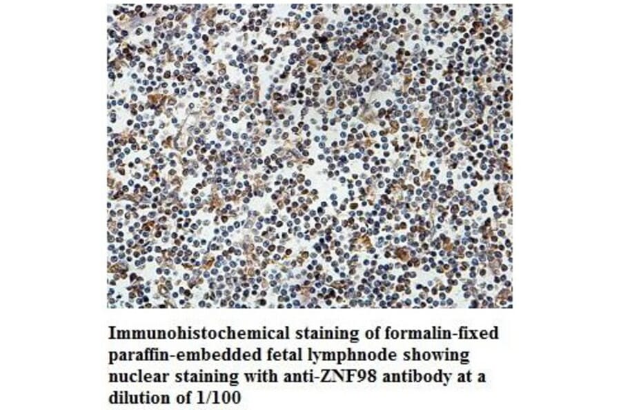 ZNF98 Antibody from Signalway Antibody (39831) - Antibodies.com